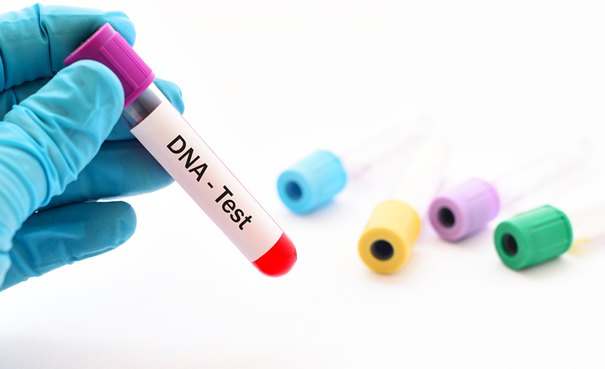 Teste de DNA caseiro é a nova onda do momento