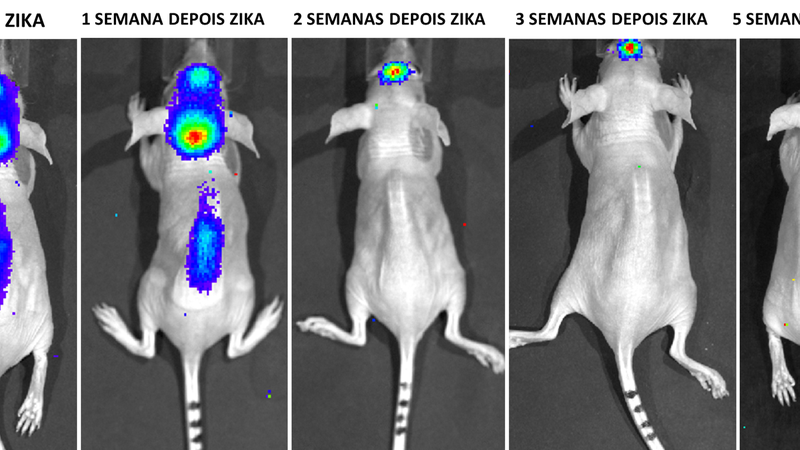 Vírus da Zika pode dar origem a tratamento para tumores de cérebro