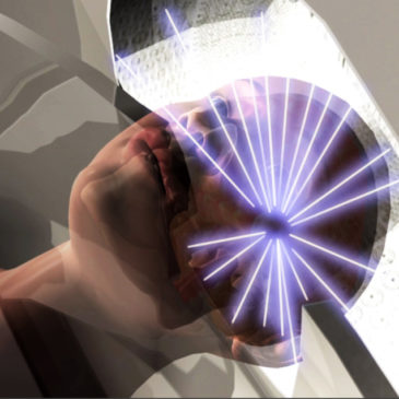 Estudo brasileiro dá aval à radiocirurgia